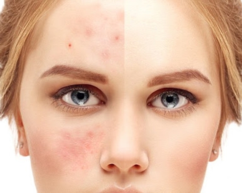 Da nhạy cảm: 6 điều mà bác sĩ da liễu muốn bạn biết
