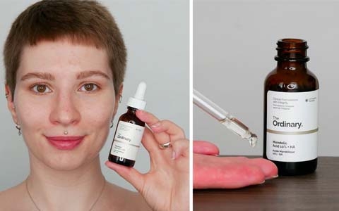 Review Serum tẩy da chết hóa học The Ordinary Mandelic Acid 10%+ HA