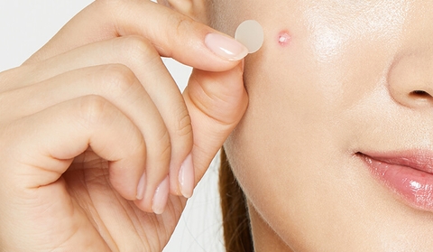 Review các chấm mụn và kem trị mụn giá
