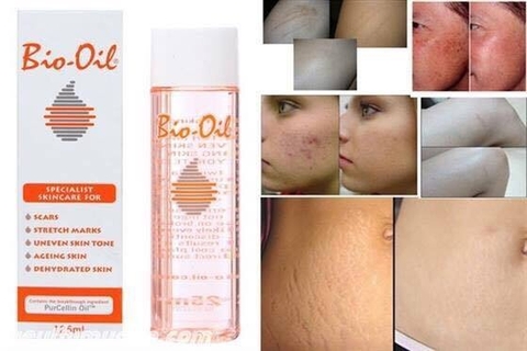 Tinh dầu trị rạn Bio Oil