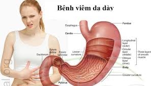 XÉT NGHIỆM NHẬN BIẾT VIÊM LOÉT DẠ DÀY