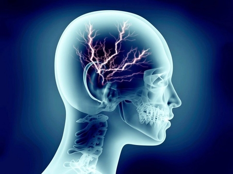 Sức khỏe não bộ