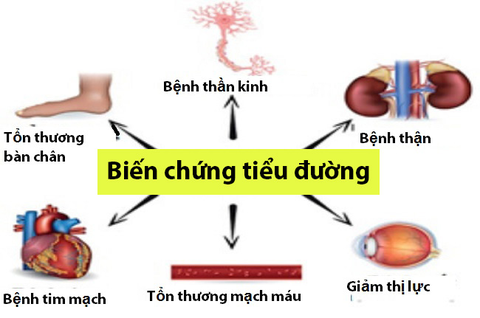 Bạn đang ở giai đoạn nào của bệnh rối loạn chuyển hóa glucose