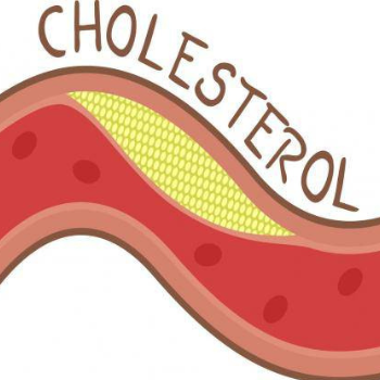Giảm cholesterol giúp giảm máu nhiễm mỡ, đột quỵ