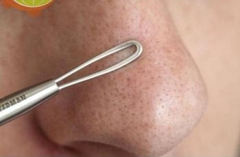 Cây Nặn Mụn Innisfree Eco Beauty Tool Extractor Cây Nặn Mụn Innisfree Eco Beauty Tool Extractor