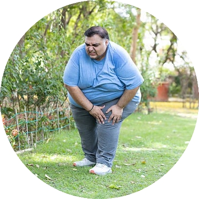 Béo phì là nguyên nhân chính gây ra thoái hóa khớp gối