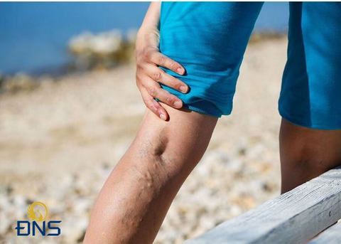 Bị chuột rút, sưng chân, mỏi chân, nổi gân xanh ở tay chân là bệnh gì?