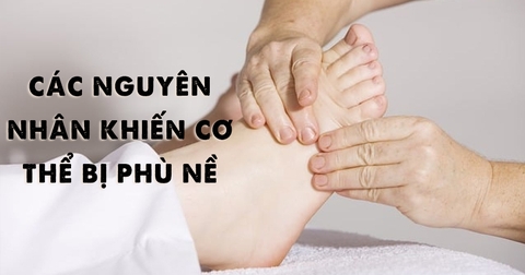 Các nguyên nhân khiến bạn bị phù nề