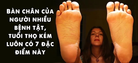 Bàn chân của người nhiều bệnh tật, tuổi thọ kém luôn có 7 đặc điểm, bạn có không?
