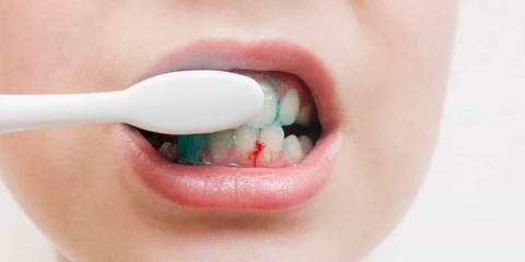 8 sai lầm nghiêm trọng khi chăm sóc răng miệng bạn cần tránh ngay lập tức