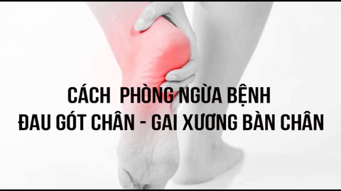 4 Cách Chữa Gai Gót Chân An Toàn Và Hiệu Quả