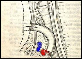 Chăm sóc bệnh nhân mở khí quản