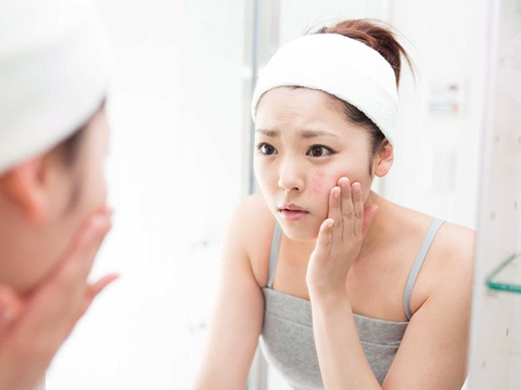 8 bước chăm sóc da dầu mụn hàng ngày tại nhà Bác Sĩ Da Liễu khuyên dùng