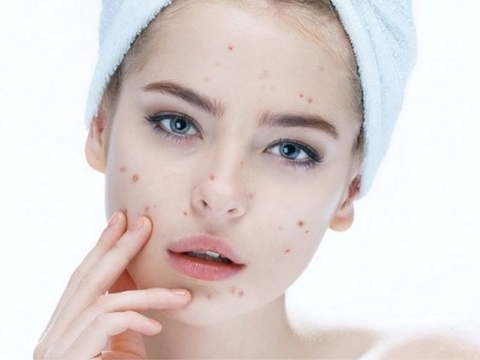 Dùng BHA bao lâu thì đẩy mụn?