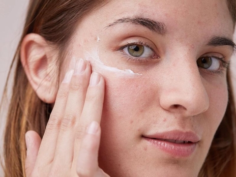 Nám da có trị triệt để không? Cách chữa nám da hiệu quả nhất