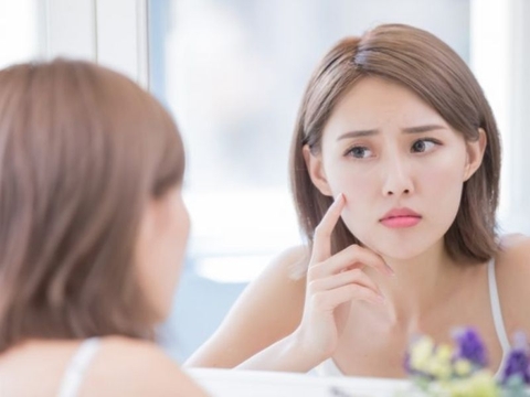 5+ cách thải độc da nhiễm corticoid hiệu quả nhất