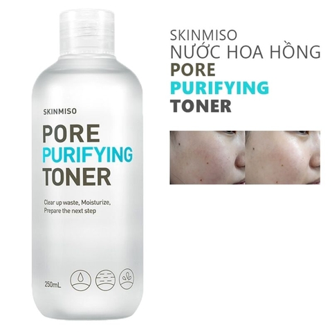 Nước hoa hồng se khít lỗ chân lông Skinmiso Pore Purifying Toner