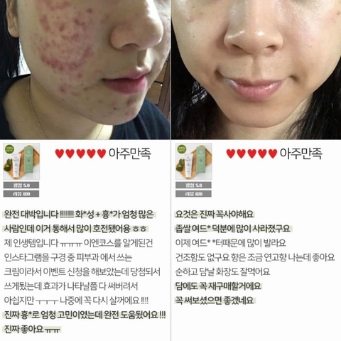 Kem phục hồi Repair Derm Cica Pro dành cho da mụn, nhạy cảm bị tổn thương