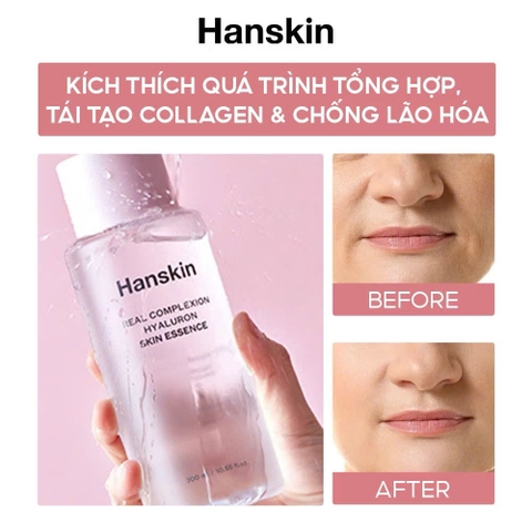 Nước Hoa Hồng Dưỡng Ẩm HANSKIN REAL COMPLEXION HYALURON SKIN ESSENCE 300ml