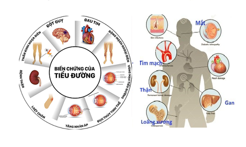 Bệnh đái tháo đường và những con số “biết nói”