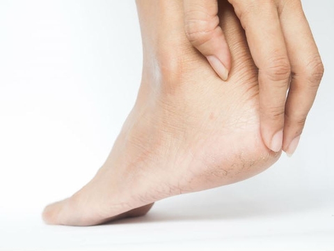 KEM DƯỠNG DA BÀN CH N HỖ TRỢ TÌNH TRẠNG KHÔ SẦN, NỨT NẺ