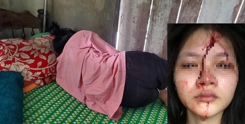 Hai nữ sinh Huế lao vào 'quyết đấu' giữa phố rồi… bắt tay làm hòa.