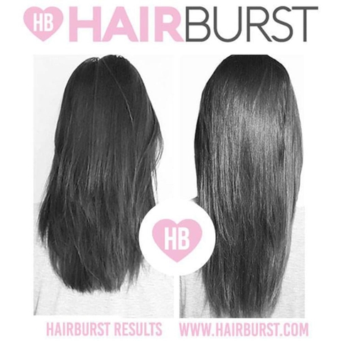 Viên uống mọc tóc, ngăn rụng tóc Hairbust