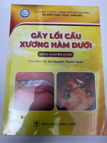 Sách Gãy lồi cầu xương hàm dưới (sách chuyên khảo)