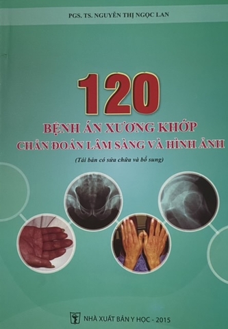 Sách - 120 bệnh án cơ xương khớp chẩn đoán lâm sàng và hình ảnh