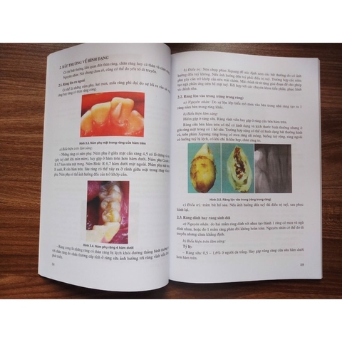 Sách - Chữa răng và nội nha tập 2