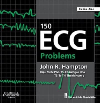 150 ECG PROBLEMS