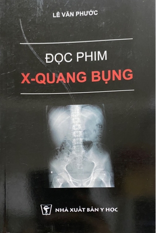 Đọc phim Xq Bụng