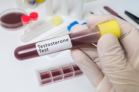 Tình trạng thiếu testosterone ở nam giới và cách khắc phục