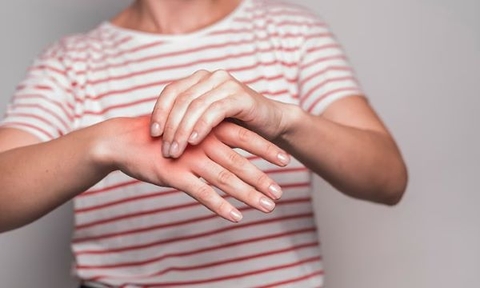 Giải đáp: Bị viêm khớp dạng thấp kiêng ăn gì?