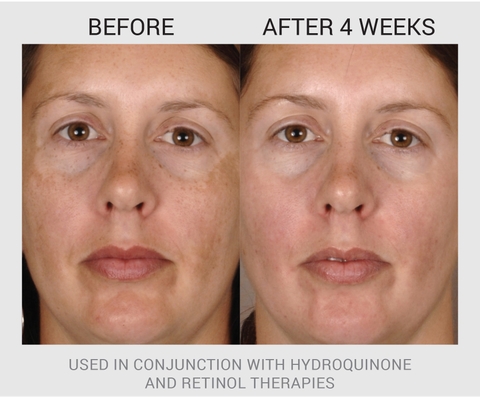 ADVANCED BRIGHTENING DAILY PADS