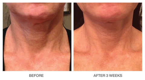 NECK TIGHTENING EDELWEISS + PEPTIDE CREAM
