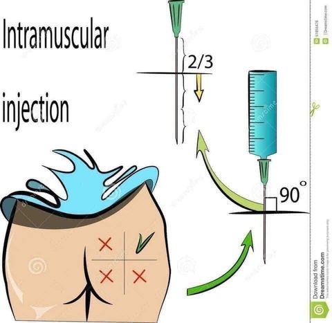 Kỹ thuật tiêm Mông, tiêm đùi không đau cho - Những điều cần lưu ý