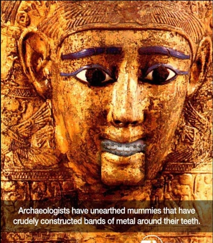 LỊCH SỬ NGÀNH CHỈNH NHA LỊCH SỬ NGÀNH CHỈNH NHA