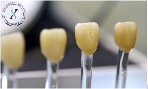 Phục hình răng cố định giải pháp hiệu và lâu dài Phục hình răng cố định giải pháp hiệu và lâu dài