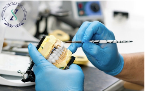 Phục hình răng - học gì để làm kỹ thuật viên phục hình răng  Phục hình răng - học gì để làm kỹ thuật viên phục hình răng