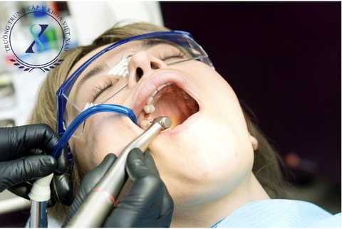 Mất răng số 7 hàm trên có ảnh hưởng gì không Mất răng số 7 hàm trên có ảnh hưởng gì không