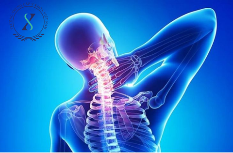 Đau cổ vai gáy điều trị theo phương pháp y cổ truyền Đau cổ vai gáy điều trị theo phương pháp y cổ truyền