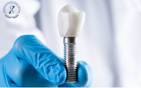 Phục Hình Răng Bằng Phương Pháp Hiện Đại Cấy Implant Phục Hình Răng Bằng Phương Pháp Hiện Đại Cấy Implant
