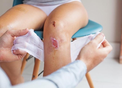 Nhiễm trùng vết mổ là gì?