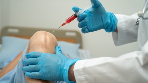 Lưu ý khi sử dụng tế bào gốc giúp tối ưu tính hiệu quả, an toàn