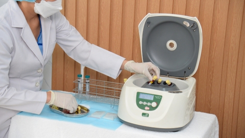 PRP là gì? Những điều cần biết về phương pháp PRP huyết tương giàu tiểu cầu