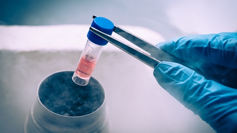 Bí quyết trẻ hóa làn da với tế bào gốc stem cell