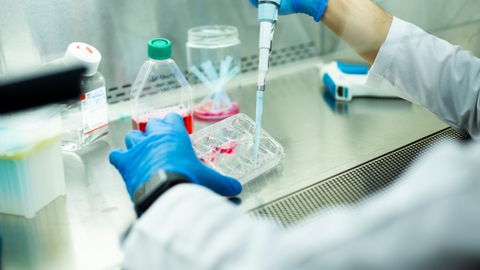 Tế bào gốc stem cell giá bào nhiều? 05 hiệu quả ưu việt tế bào gốc mang lại