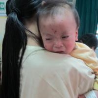 Mẹ cần biết để phòng bệnh sởi cho con Mẹ cần biết để phòng bệnh sởi cho con