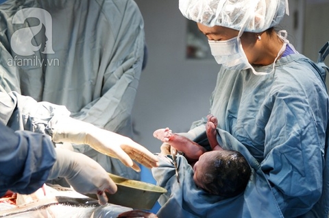 Tất tần tật những điều về sinh mổ mẹ bầu nên biết Tất tần tật những điều về sinh mổ mẹ bầu nên biết